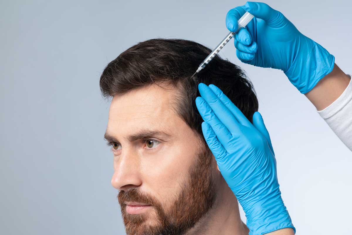 PRP Hair Restoration in Edmonton: The Non-Surgical Way to Fight Back Against Hair Loss